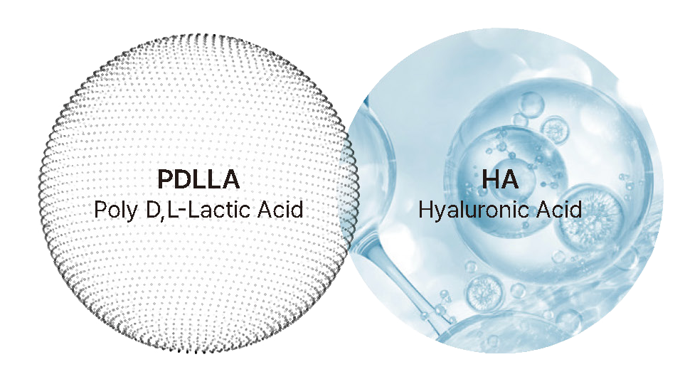 Sculptiva PDLLA + HA recommended application areas